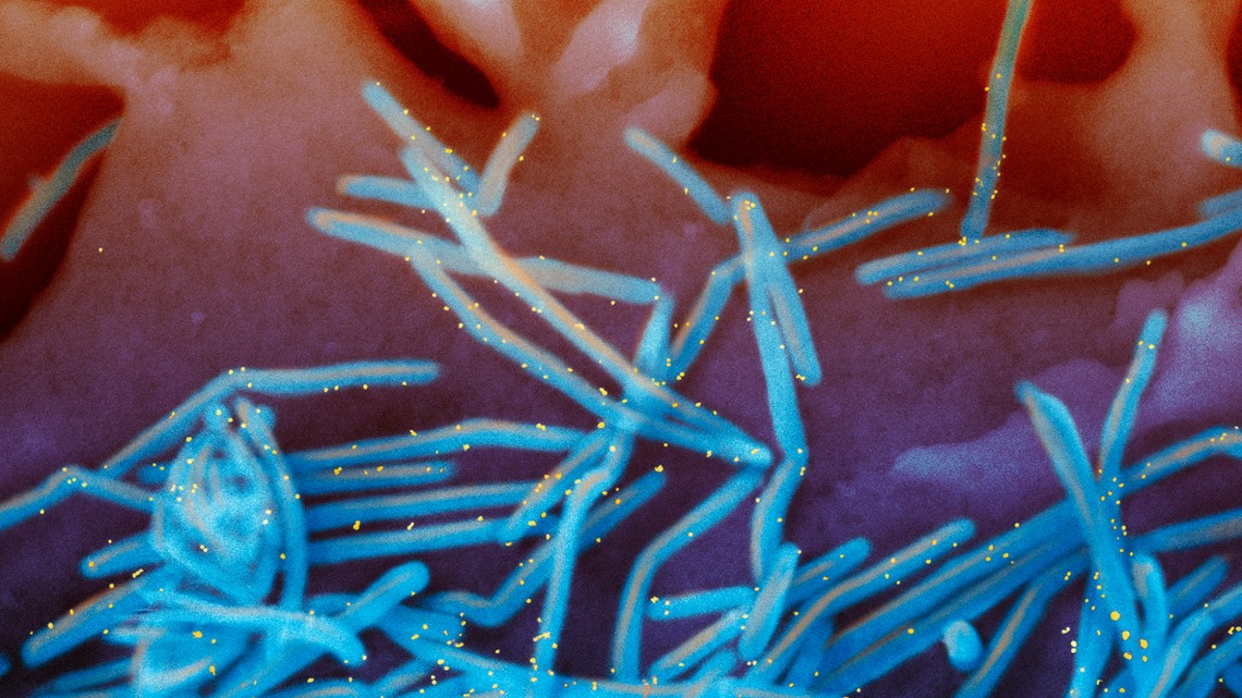 FDA advisers back RSV vaccine for pregnant women FDA advisers back RSV vaccine for pregnant women