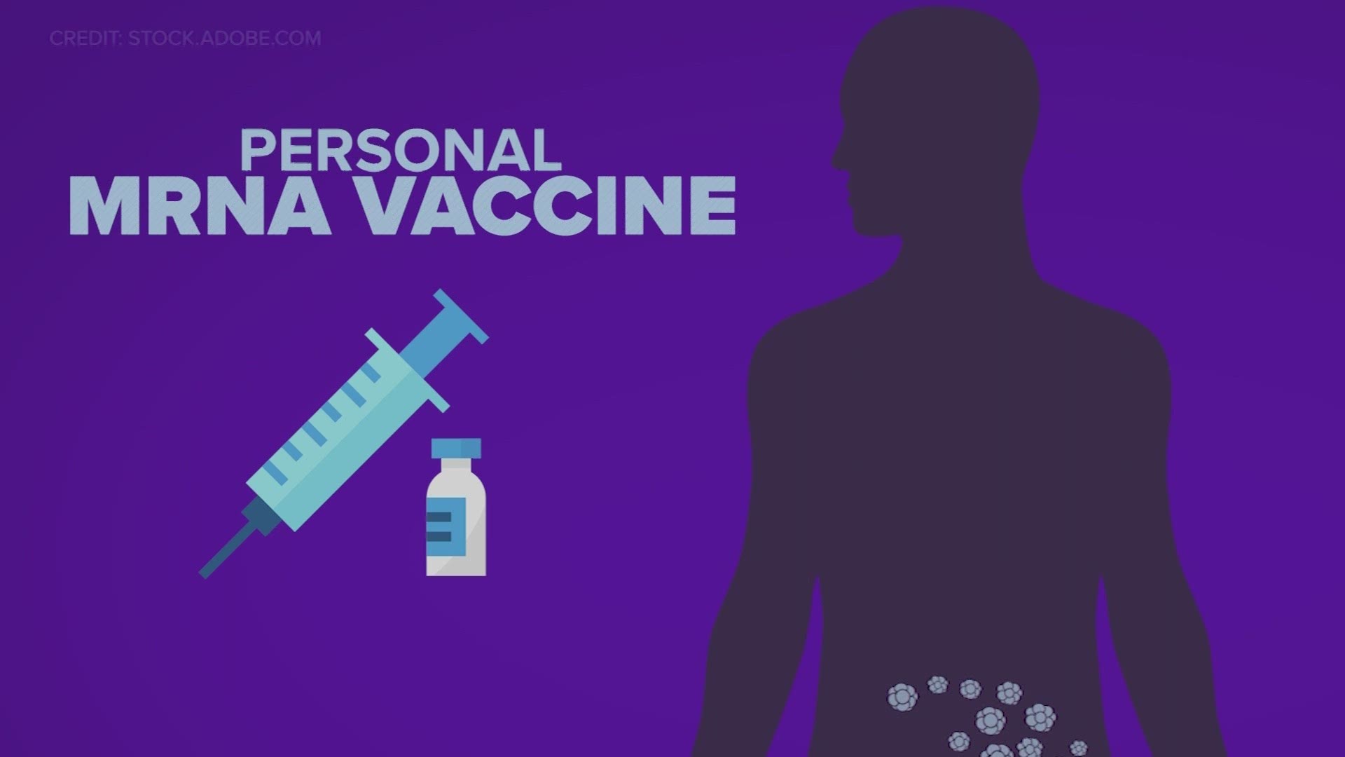 A new clinical trial will test if mRNA vaccines can eradicate cancer for stage two and stage three colon cancer patients.