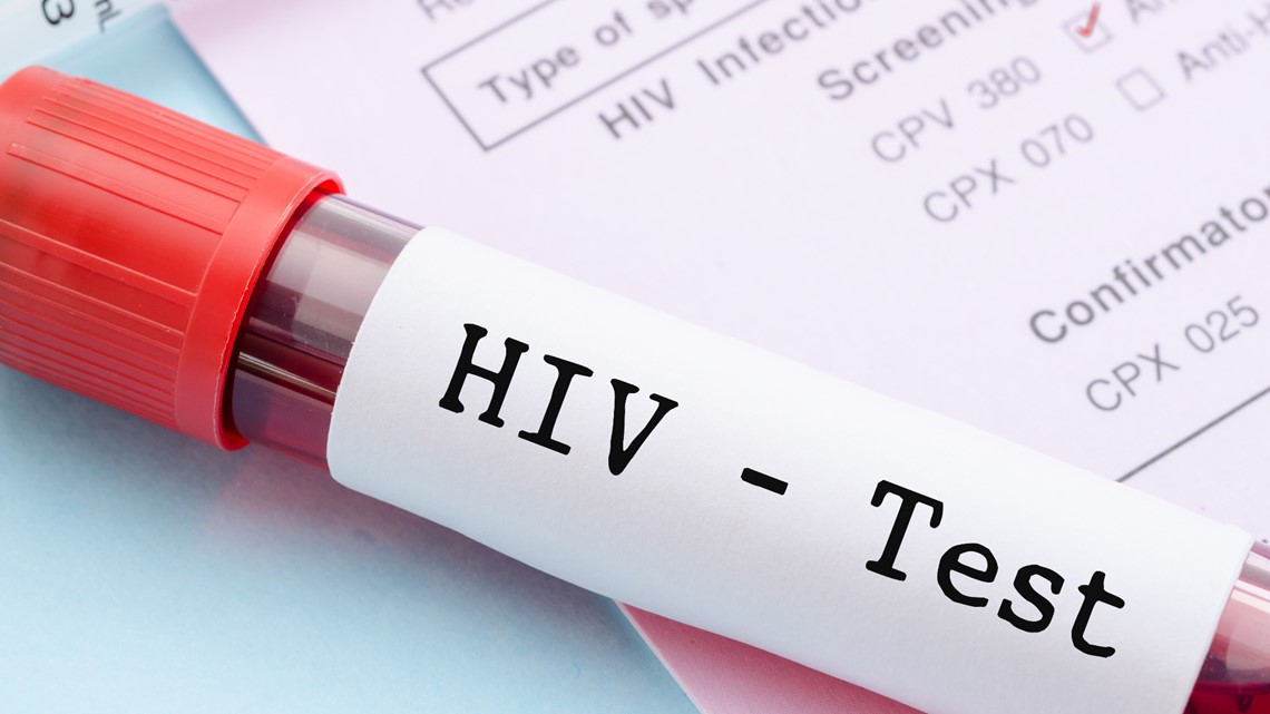 Free HIV testing available in downtown Toledo - Vimarsana News