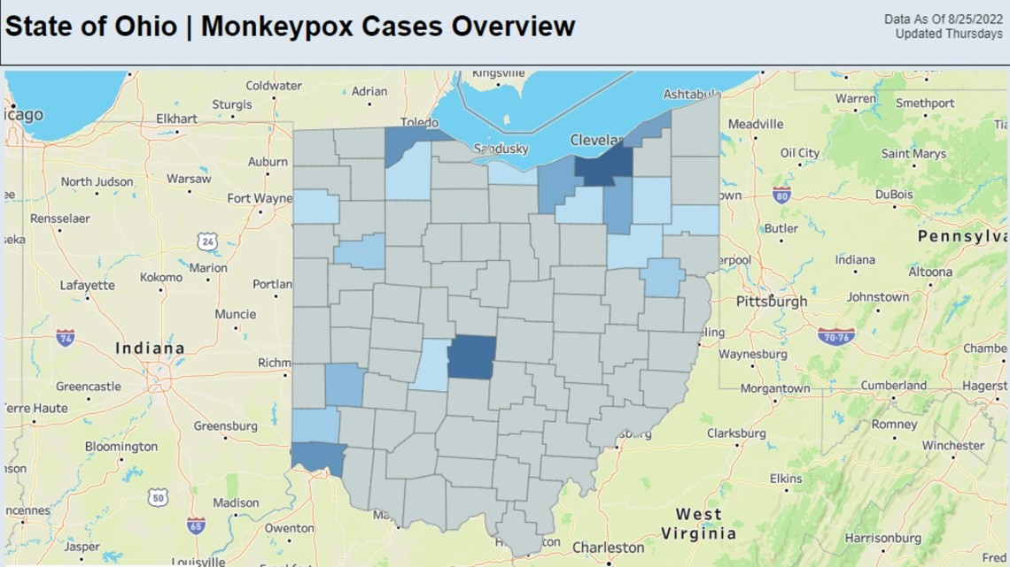 Ohio Department of Health launches monkeypox dashboard - Vimarsana News