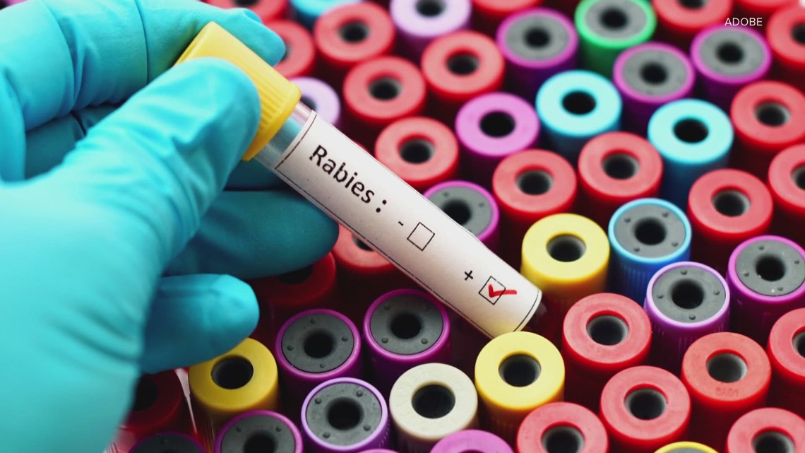 Lucas County coroner: Person dies of rabies after contracting virus from transplanted organ - WTOL