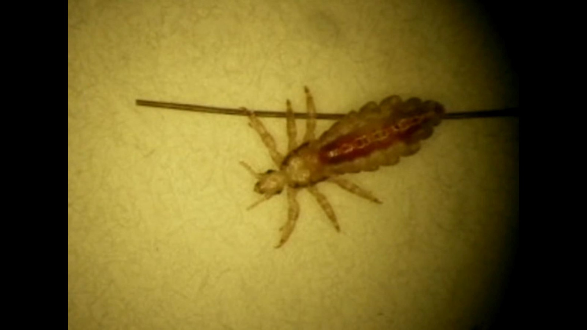 Be on the lookout for head lice lurking in Halloween costumes