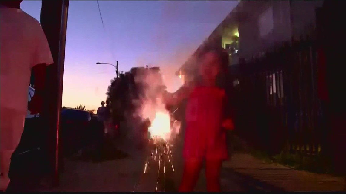 July Fourth means fireworks – and along with it - fireworks injuries