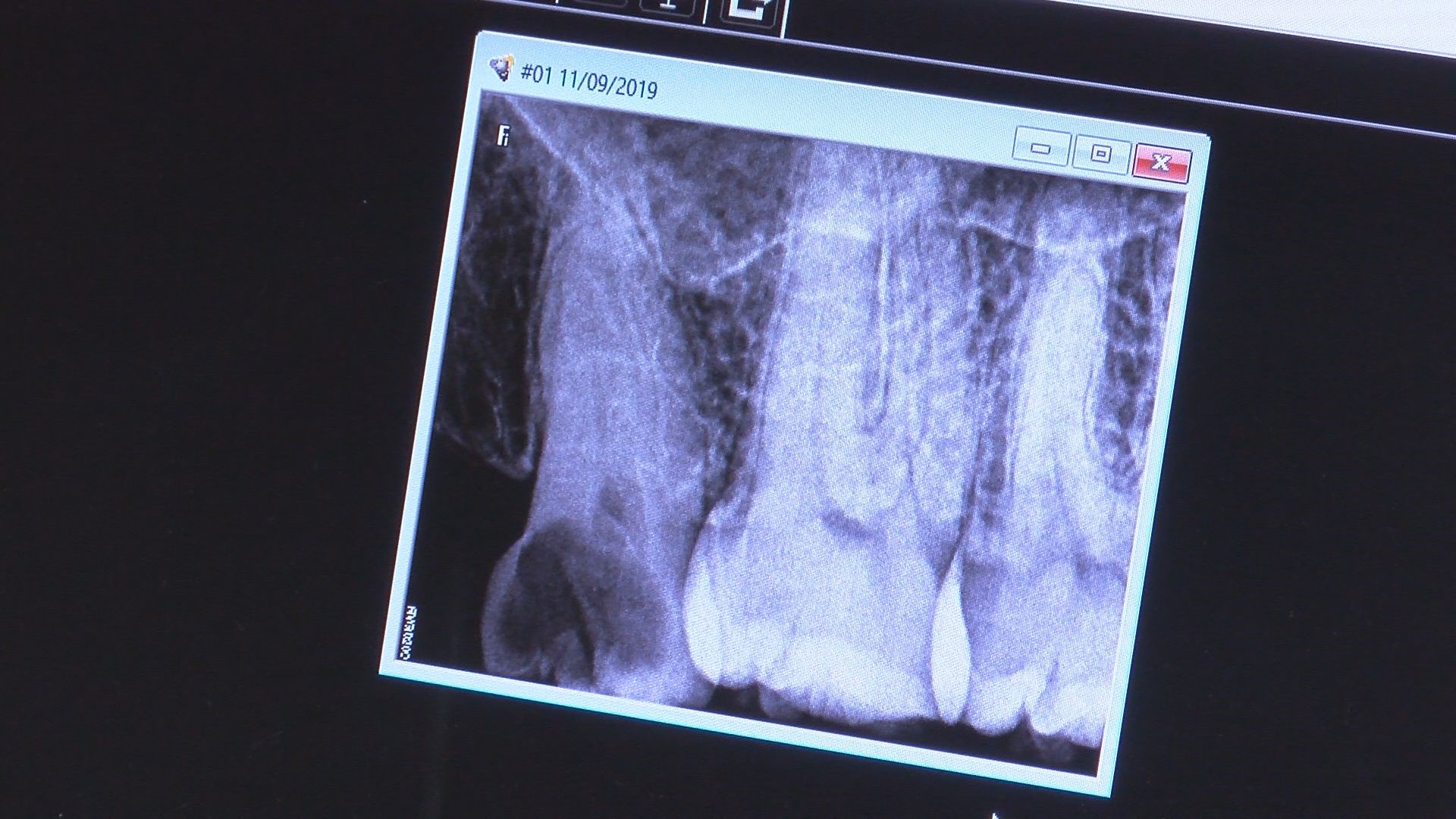 Where can you get free dental or medical care in Toledo area?