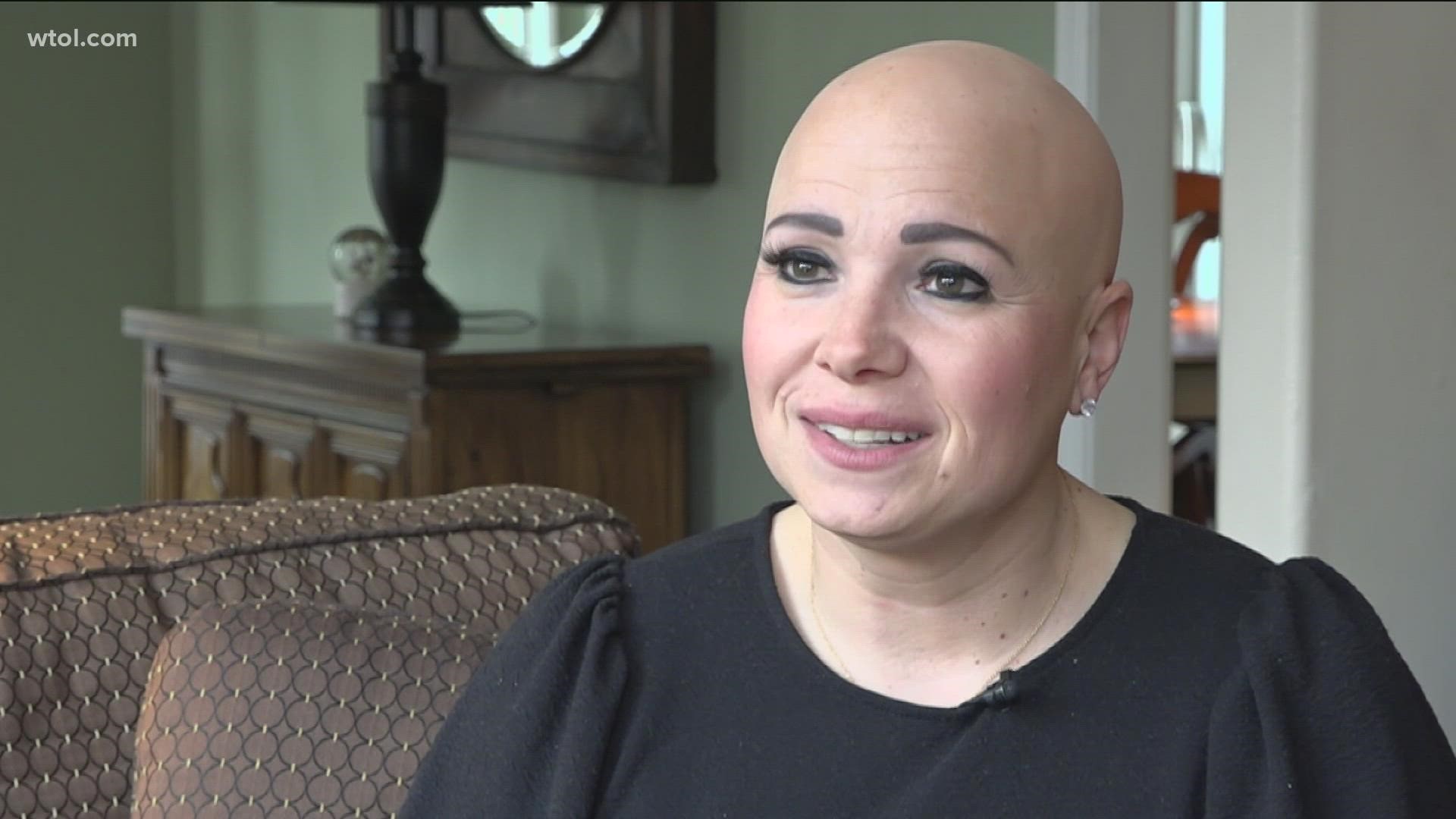 "This has opened up an opportunity for other people with alopecia to bring awareness and educate not only our community but the world."