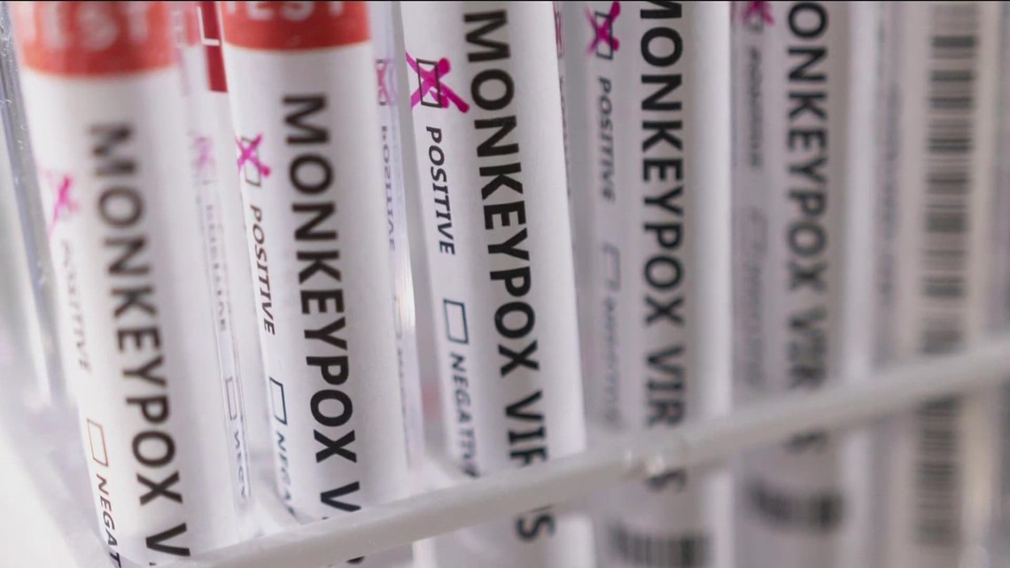 Federal researchers charged with smuggling monkeypox samples through Detroit Metro Airport