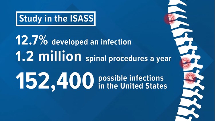 Surgery and infection rates