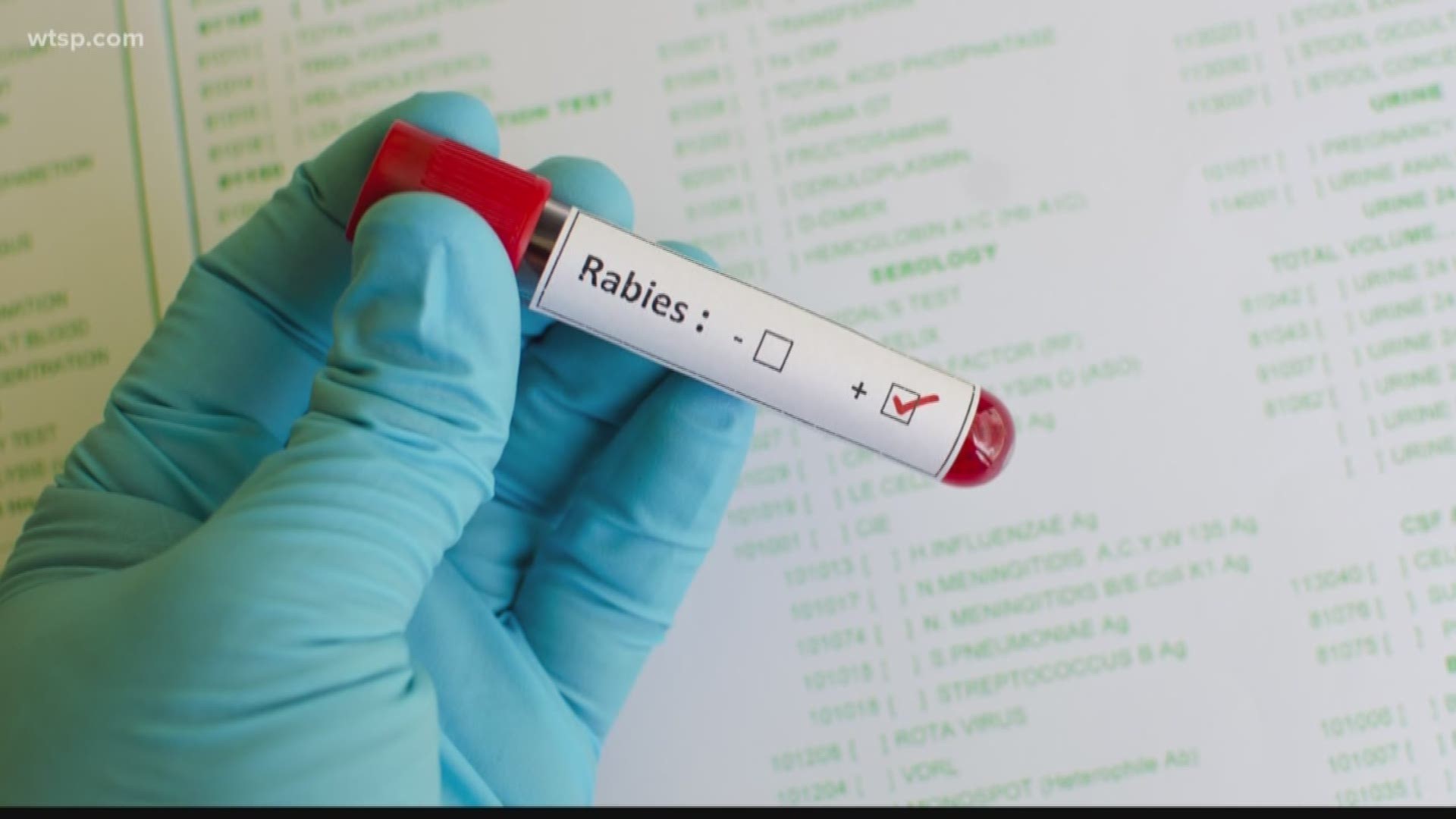 We go Beyond the Headline to learn more about how one contracts rabies.